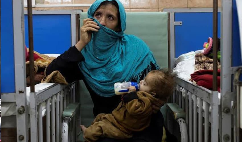 Afghan-children-face-acute-malnutrition