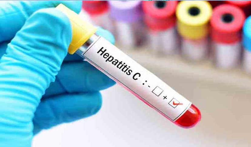 Centre plans hepatitis-free regions (Courtesy: File)