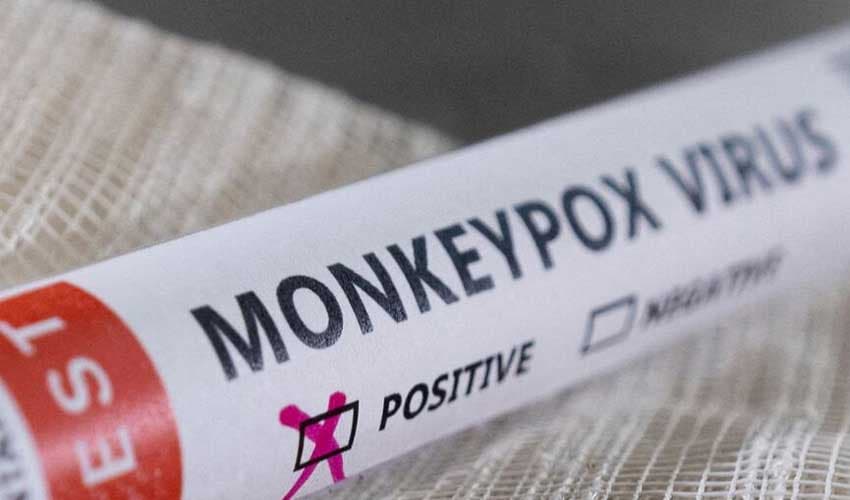 Another mpox case takes Karachi tally to 10 (Courtesy: File) Another mpox case takes Karachi tally to 10 (Courtesy: File)