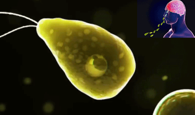 Young man dies in Karachi after contracting brain-eating amoeba (Courtesy: Online)