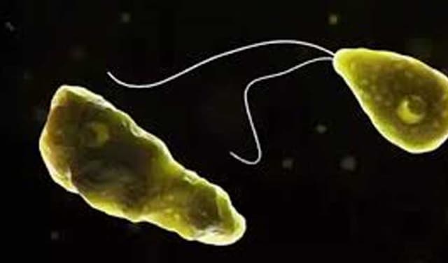 Karachi reports fifth naegleria-related death (Courtesy: Online)