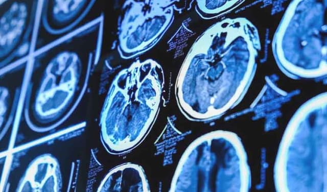 brain