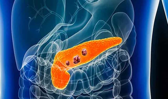 File photo