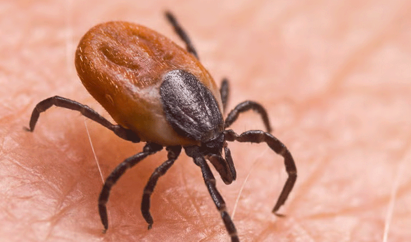 Another Congo virus case reported in Karachi (Courtesy: File)