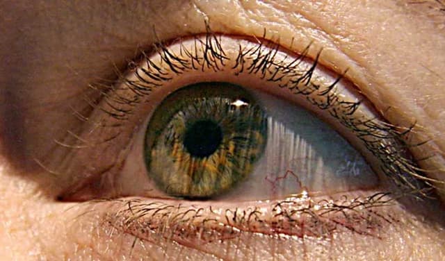 eye