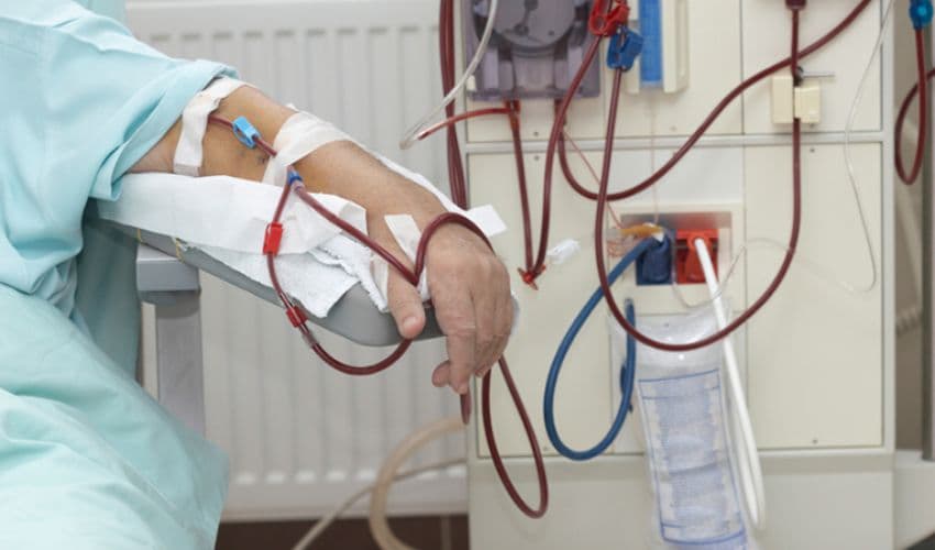 Free kidney dialysis Free kidney dialysis