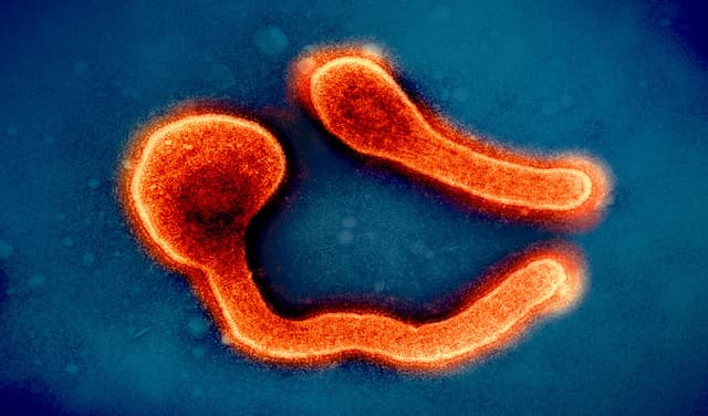 US govt issues travel advisory against visiting Rwanda amid Marburg virus outbreak