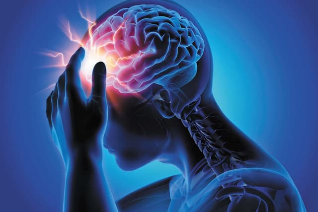 Migraine Pain