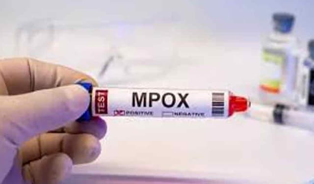 Another mpox case surfaces in Lahore(Courtesy: Online)