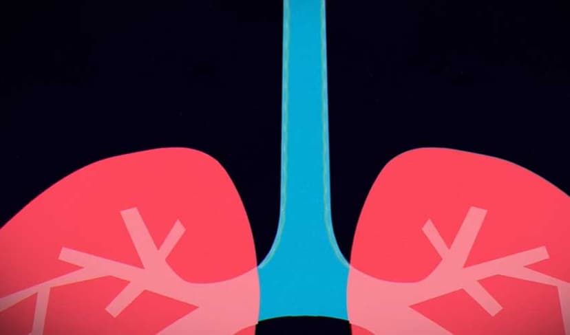 14 succumbed to pneumonia in last 24 hours – File