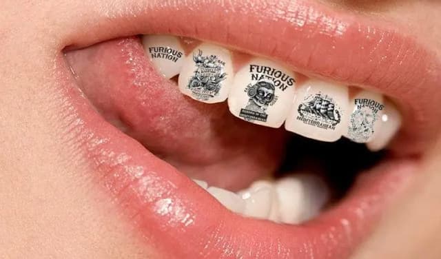 Rising trend of tattoos on teeth raises dental health concerns (Courtesy: File)