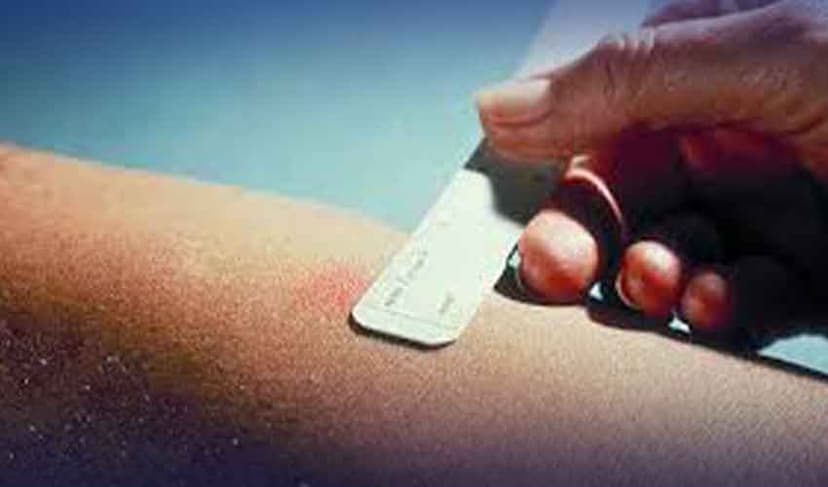 Over 93,000 children affected by tuberculosis each year in Pakistan (Courtesy: File)