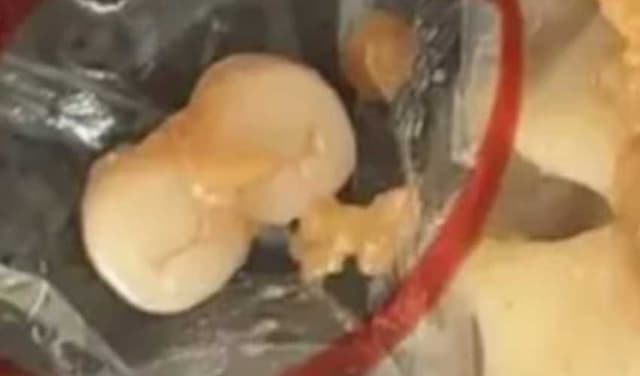 Human teeth found in food items spark anger across China (Courtesy: Online)