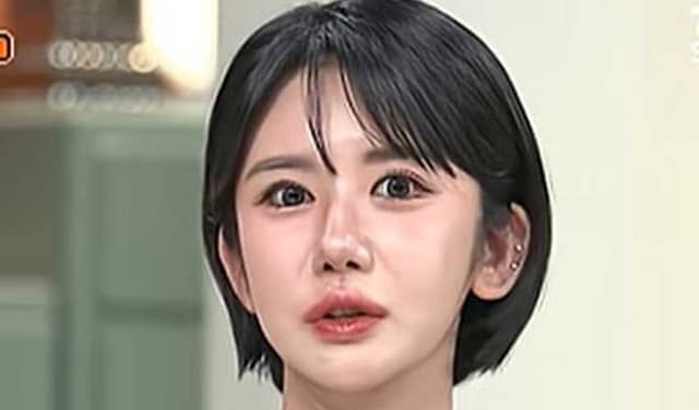 South Korean woman undergoes 400 cosmetic procedures over 15 years (Courtesy: File)