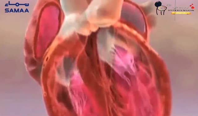 World Hypertension Day being observed globally today (Courtesy: Samaa Digital - art work)