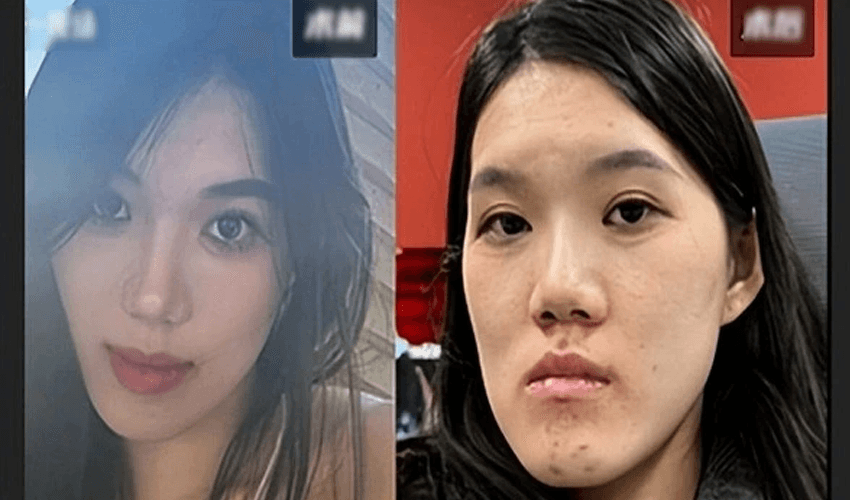Woman’s face severely affected after negligence during cosmetic surgery (Courtesy: File) Woman’s face severely affected after negligence during cosmetic surgery (Courtesy: File)
