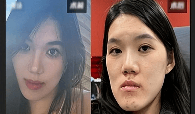 Woman’s face severely affected after negligence during cosmetic surgery Woman’s face severely affected after negligence during cosmetic surgery