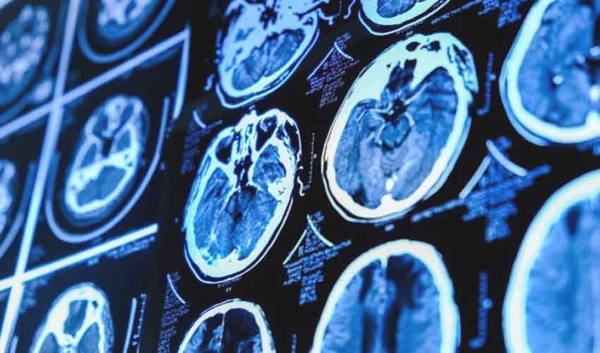 brain brain