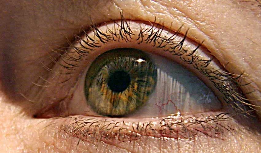 eye eye