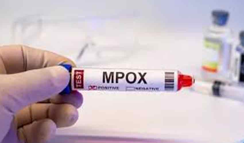 Another mpox case surfaces in Lahore(Courtesy: Online) Another mpox case surfaces in Lahore(Courtesy: Online)