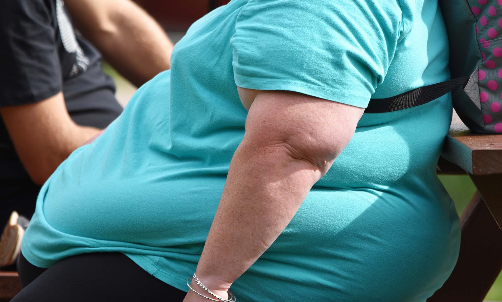Obesity Obesity