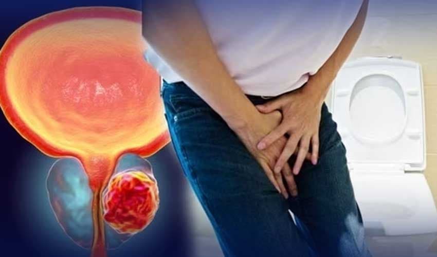 Prostate cancer Prostate cancer