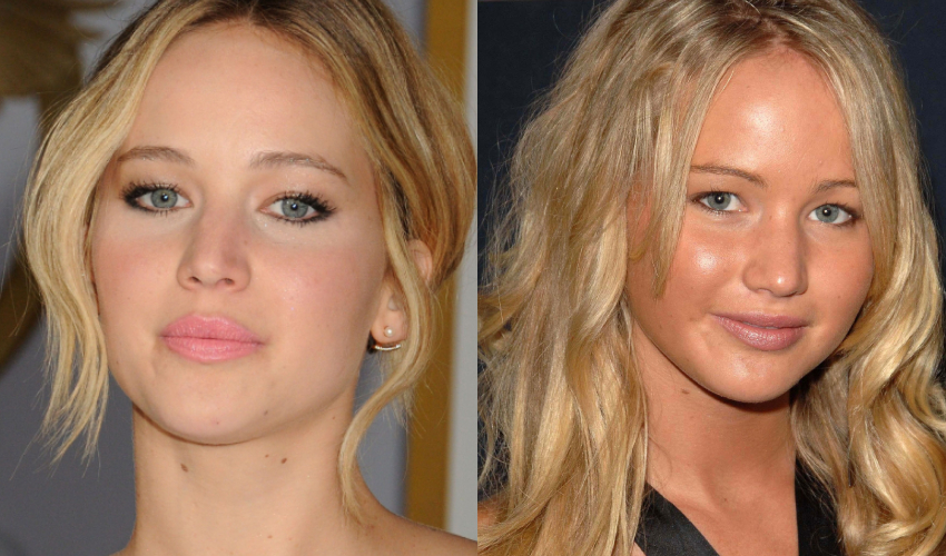 Jennifer Lawrence reveals about her plastic surgery