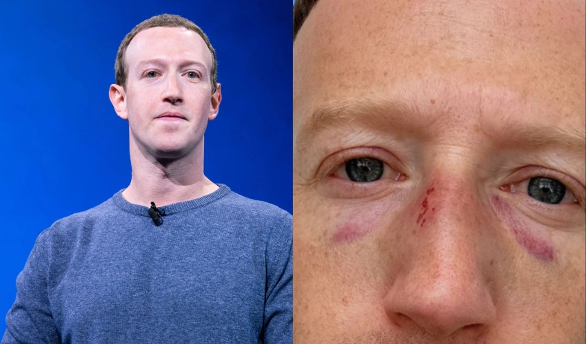 Meta CEO's Mark Zuckerberg black-eyed selfie takes internet by storm
