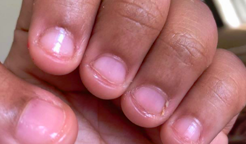 Beware nail biters: Microscopic video of nails will make you ewww!